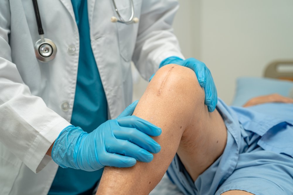 Knee Replacement